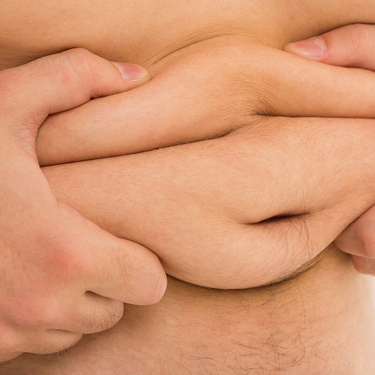 epivyziva-lexikon-nemoci-obezita