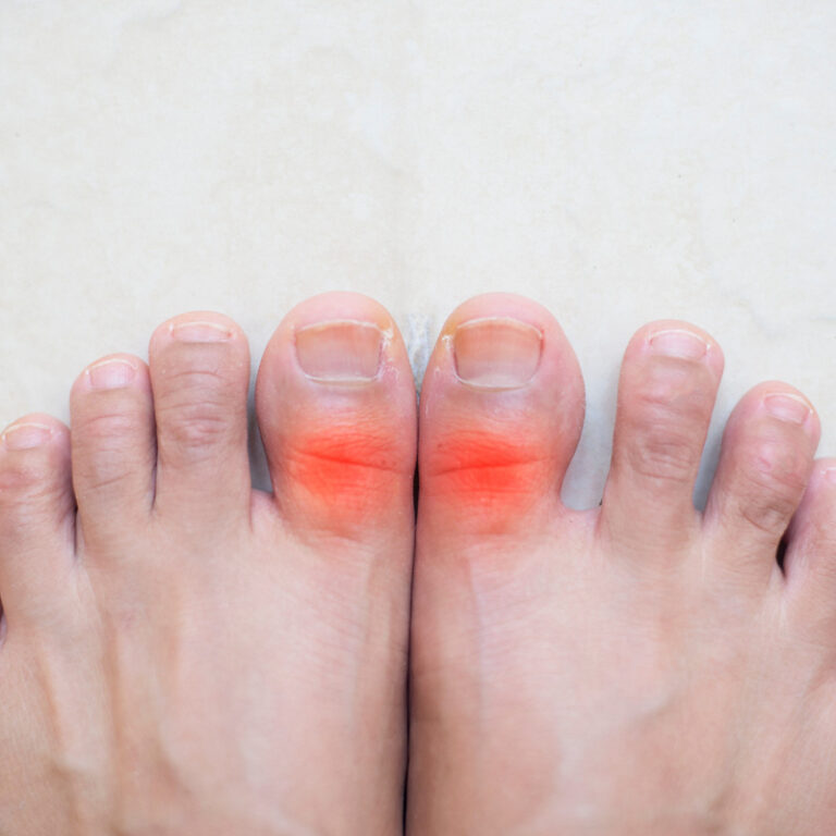 epivyziva-cz-dna-kdyz-boli-i-prikryvka-na-nohach-28022024