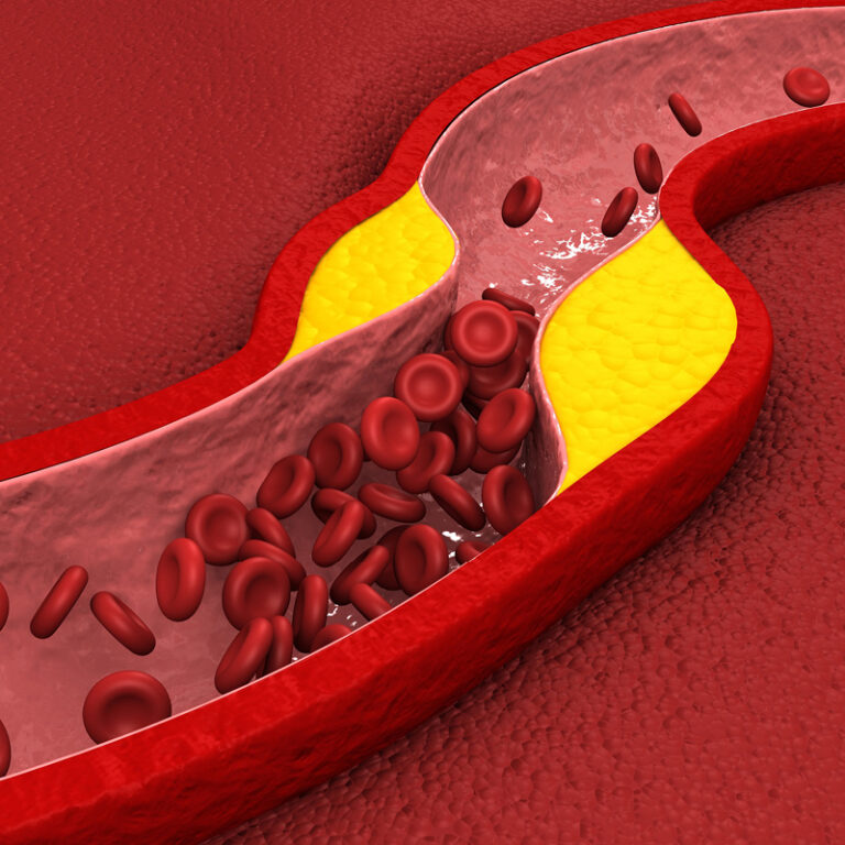 epivyziva-cz-pravda-o-cholesterolu-zabijak-nebo-neskodna-latka-18042024