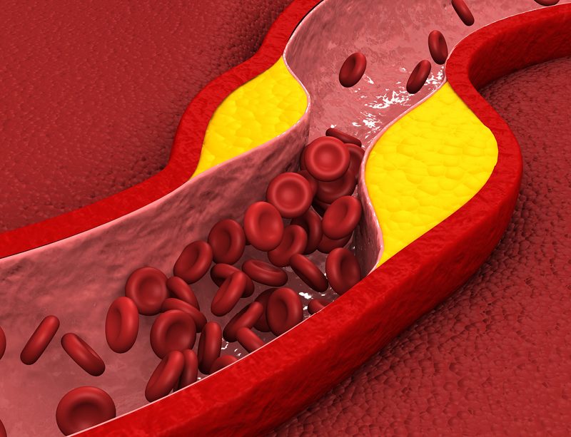 epivyziva-cz-pravda-o-cholesterolu-zabijak-nebo-neskodna-latka-18042024
