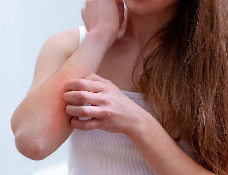 epivyziva-lexikon-nemoci-alergie