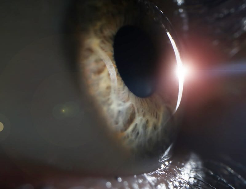 epivyziva-lexikon-nemoci-sedy-zakal