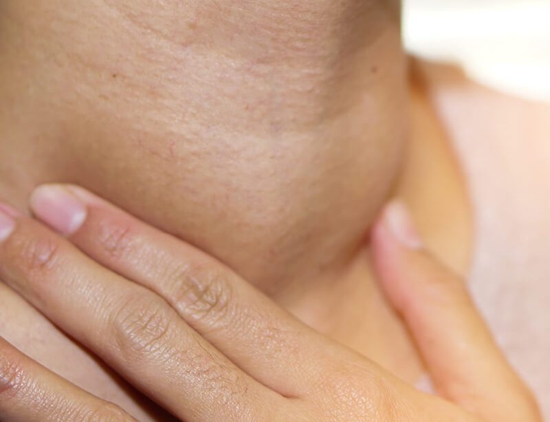 epivyziva-lexikon-nemoci-stitna-zlaza