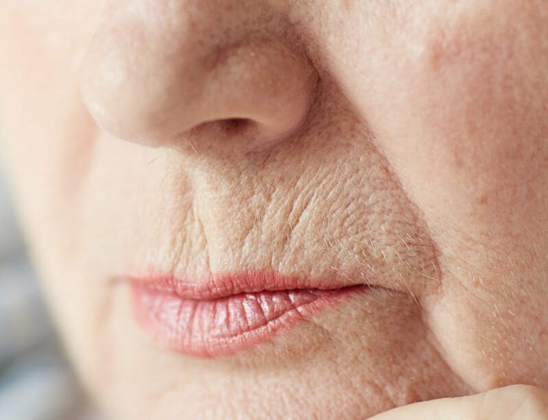 epivyziva-lexikon-nemoci-vrasky